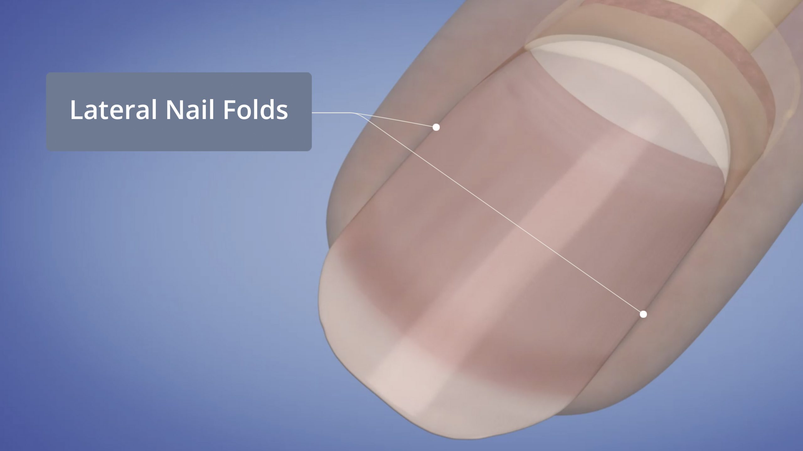 Lateral Nail Folds
