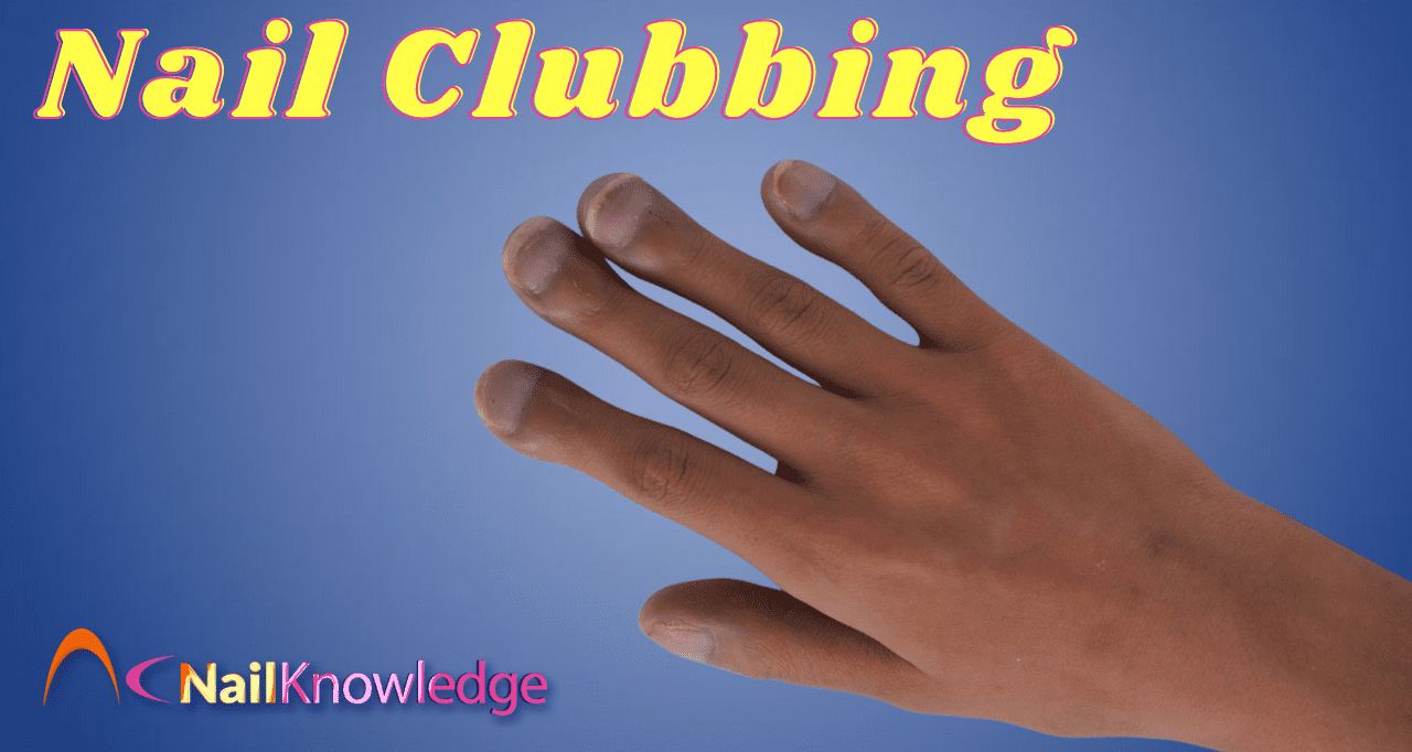 Nail Clubbing