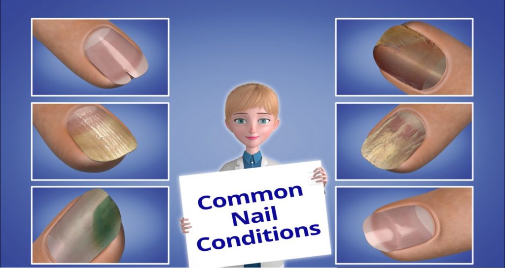 Effects Of Nutrient Deficiency On The Nails: What Do They Indicate About  Your Health?