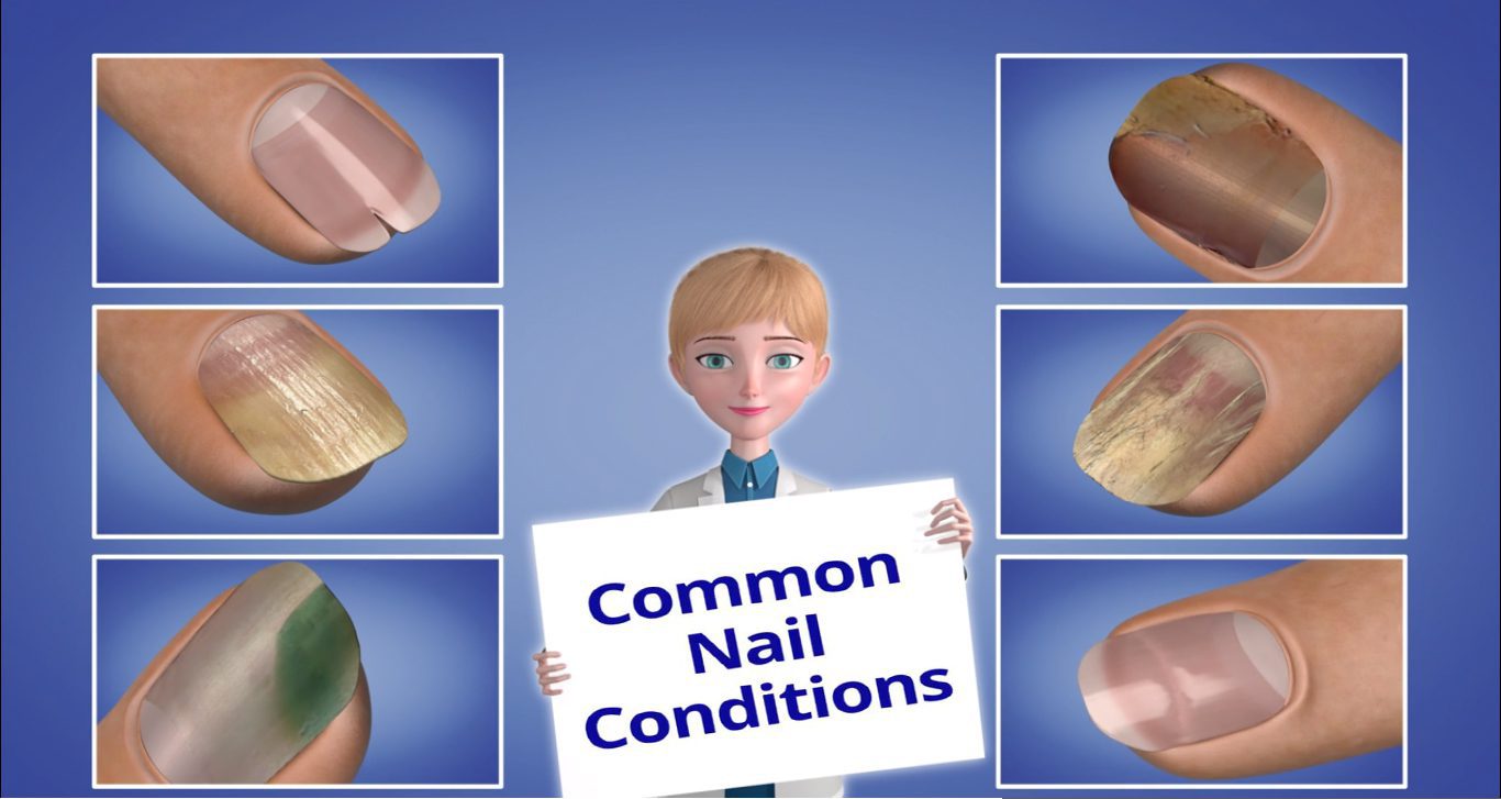 Introduction to Nail Conditions - NailKnowledge