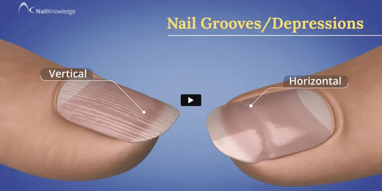 Nail grooves and depressions