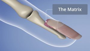 X-Ray of the Nail Matrix