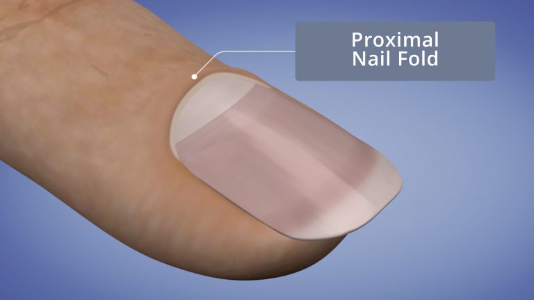 Proximal Nail Fold - NailKnowledge