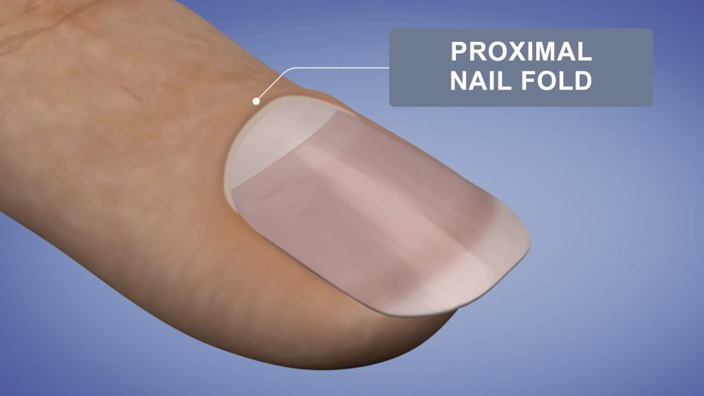 Proximal Nail Fold