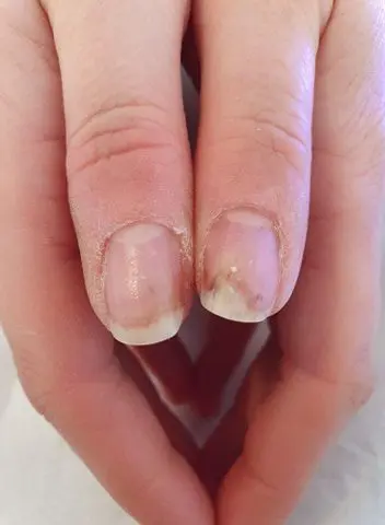 Cuticle Oil: A Blessing Or A Curse For Healthy Nails? | AllNailArt.com
