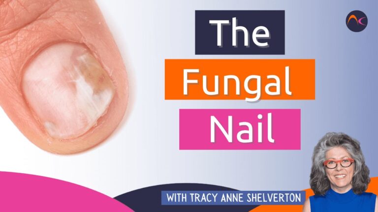 The fungal nail