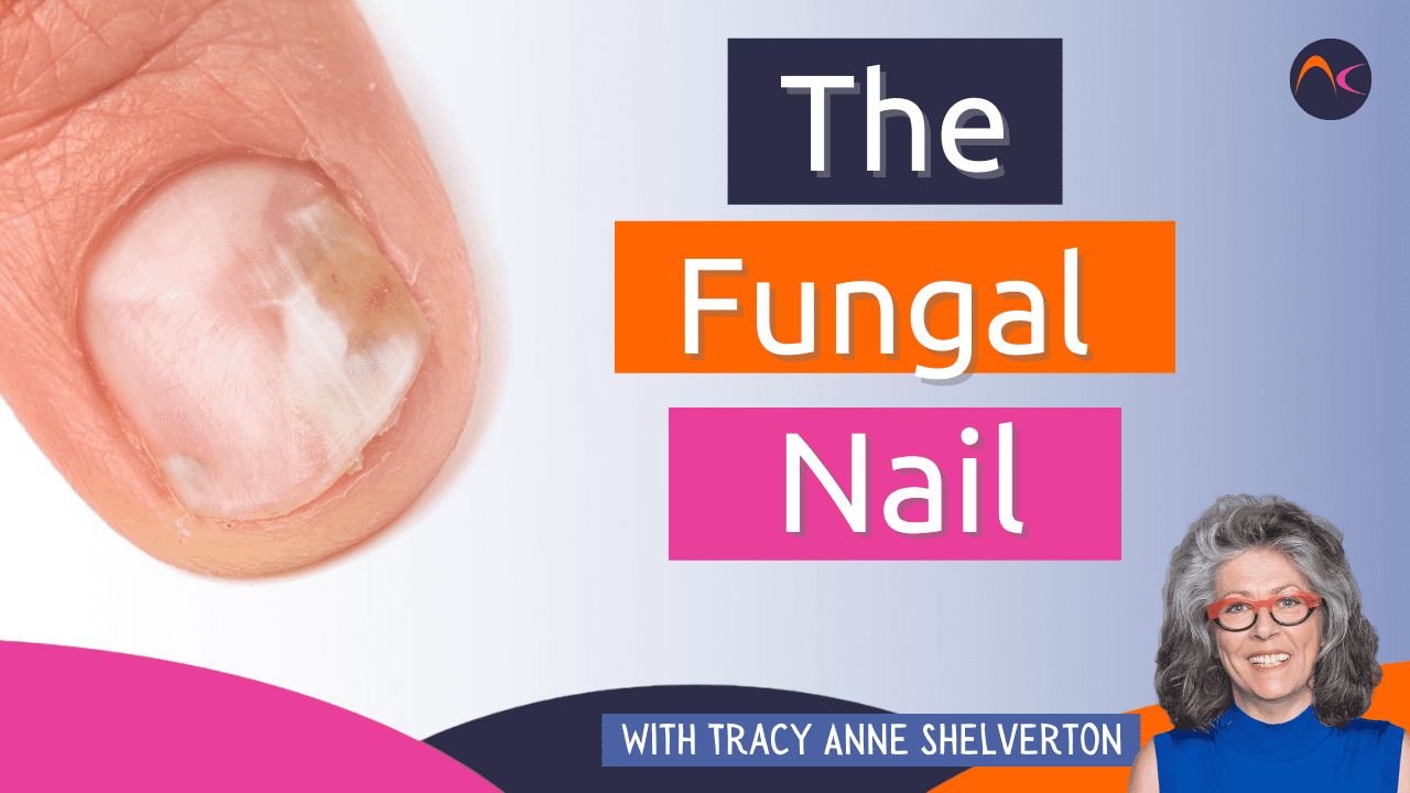 Chiropody Center Dubai » Nail Fungal Infection