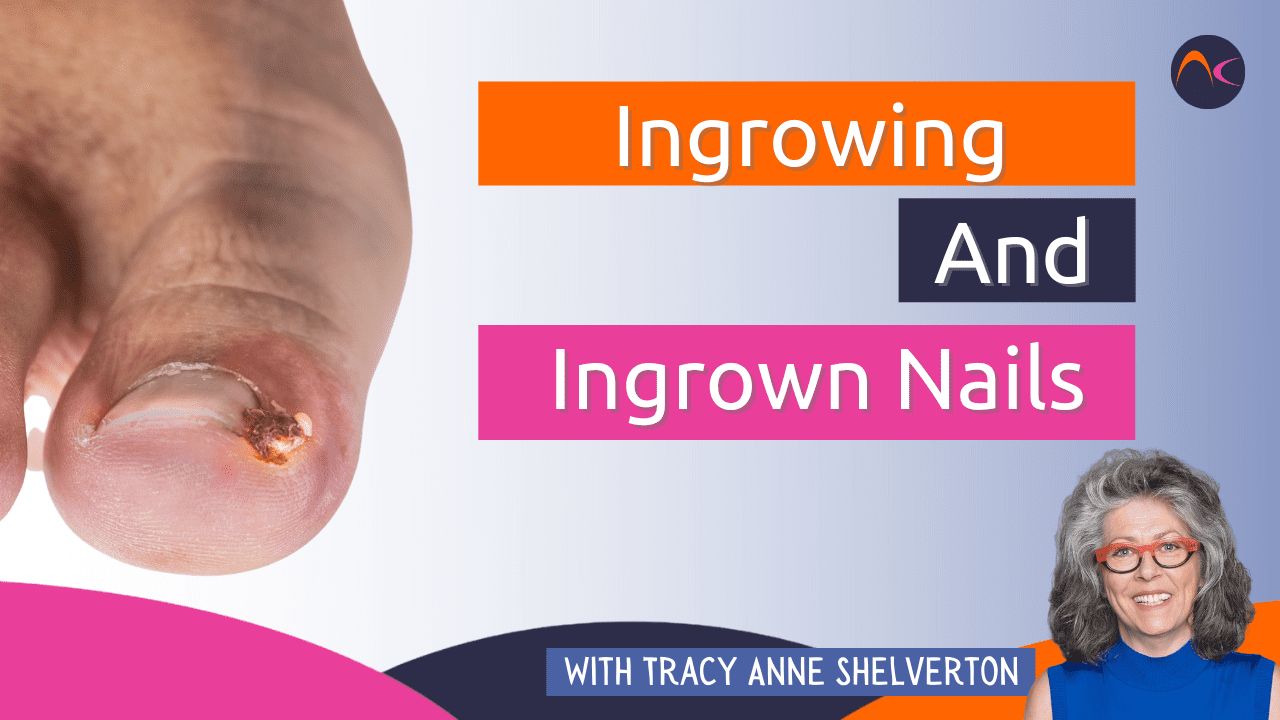 Ingrowing And Ingrown Nails - NailKnowledge