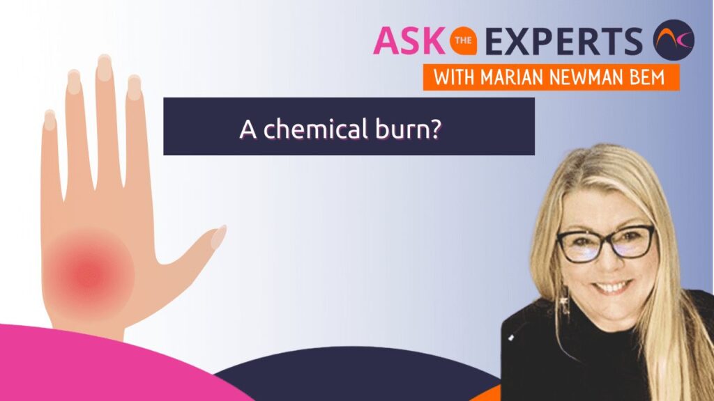 blog banner about a chemical burn