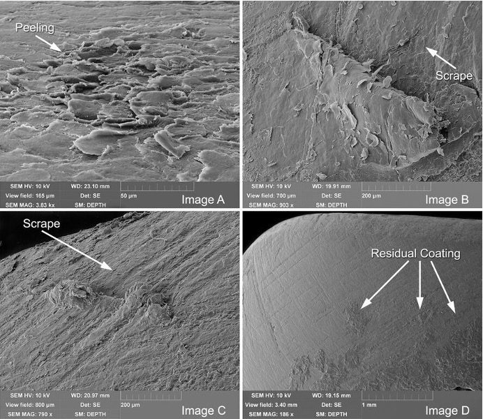 Danos às unhas naturais causados por força mecânica, vistos em um microscópio.