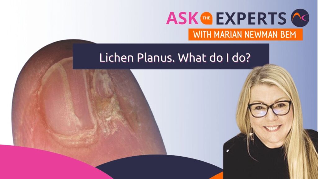 Lichen planus. What do I do?