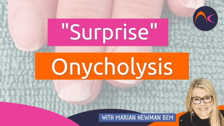 surprise onycholysis