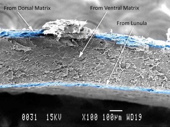 nail plate porosity, photo courtesy of Dough Schoon (Face to Face, Vol 1)