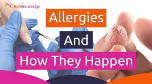 Free allergies and how they happen lesson