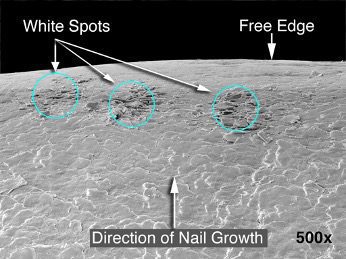 Image shows damaged nail cells where the nail polish color might deposit