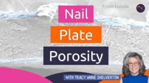 bài đăng trên blog về độ xốp của móng