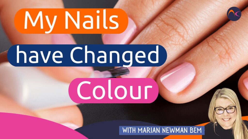 Nails changing colour
