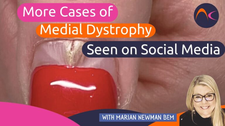 Medial Nail Dystrophy