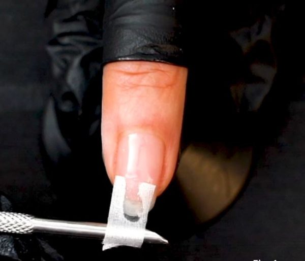 Split Nail Repair DIY Fixes and Professional Treatments NailKnowledge