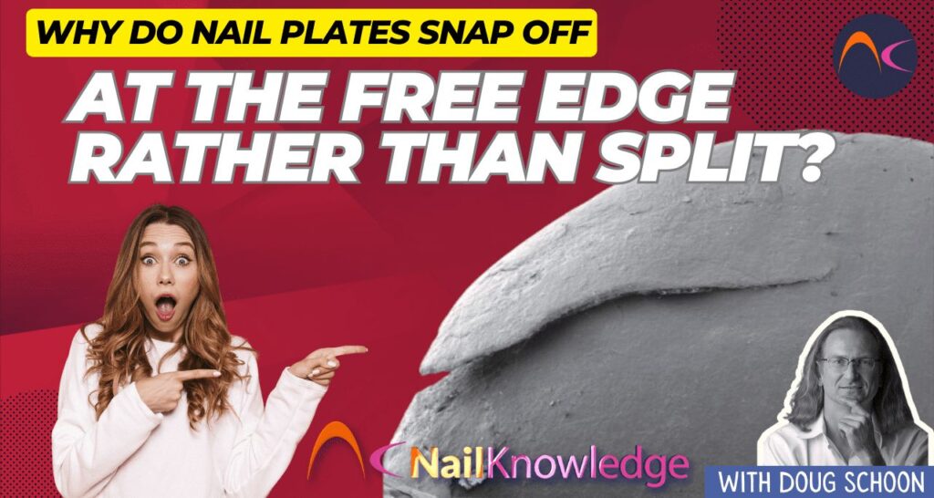 Nail plates snap off at free edge