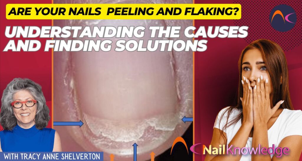 Nail peeling and flaking