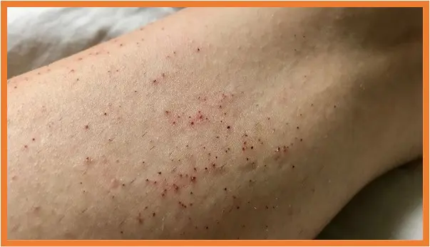 skin micro cuts