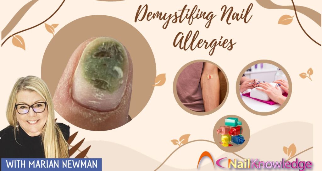 Desmistificando as alergias às unhas