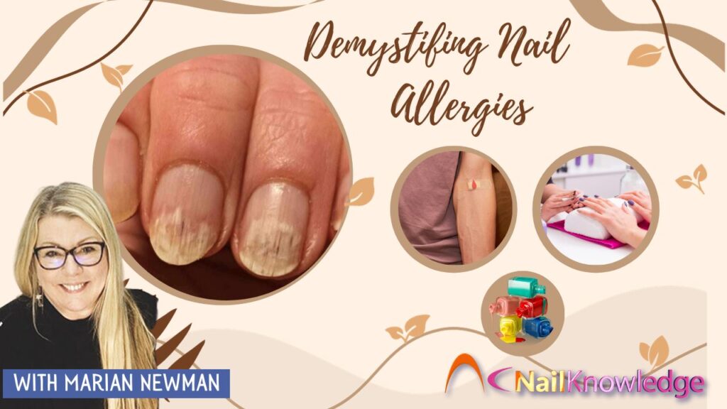 Demystifing Nail Allergies