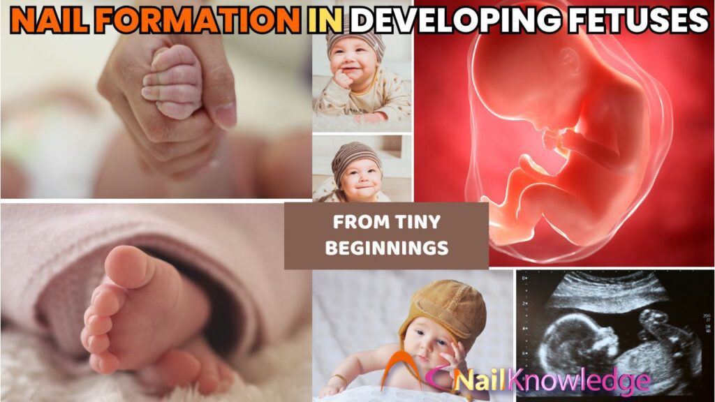 Fetal nail development