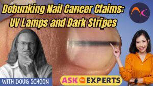 Rayas oscuras UV LAMP Cáncer susto