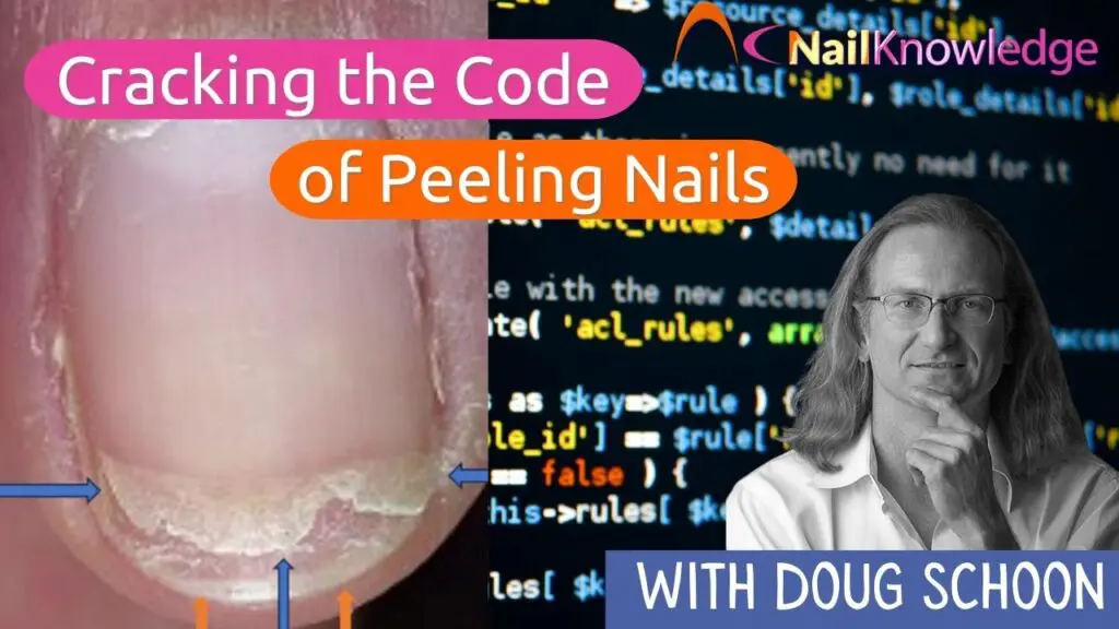 Peeling Nails - Nail Plate Peeling