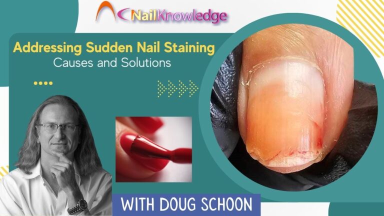Addressing Sudden Nail Staining Causes and Solutions