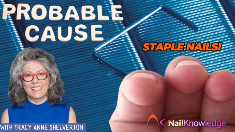 Staple Nails
