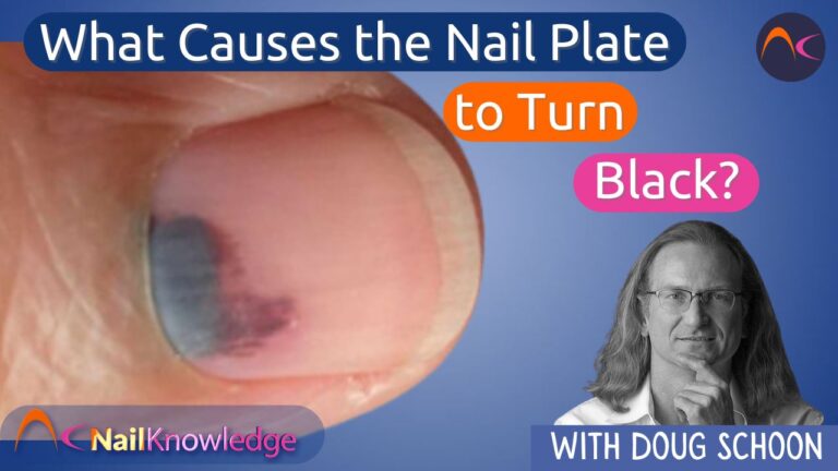 What causes the nail plate to turn black or darkly colored?