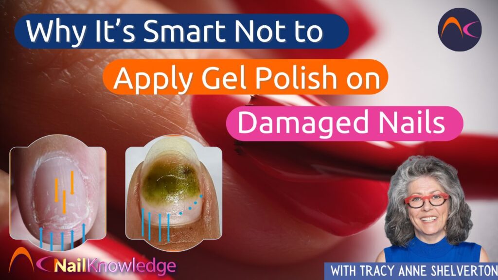 Why It’s Smart Not to Apply Gel Polish on Damaged Nails