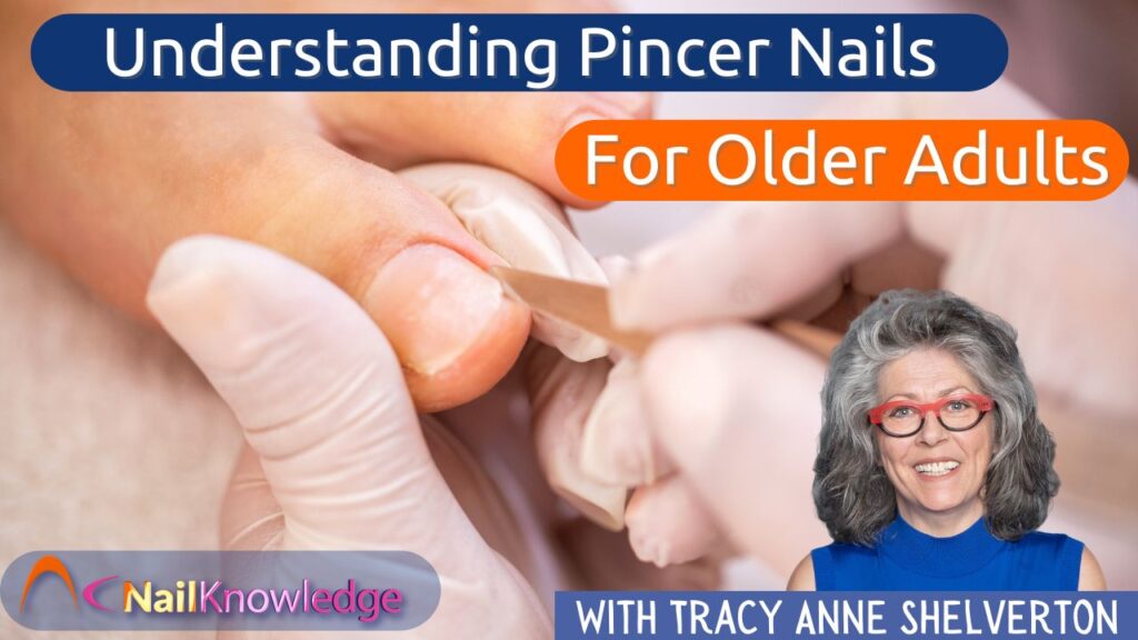 Understanding Pincer Nails Pedicure Care for Older Adults