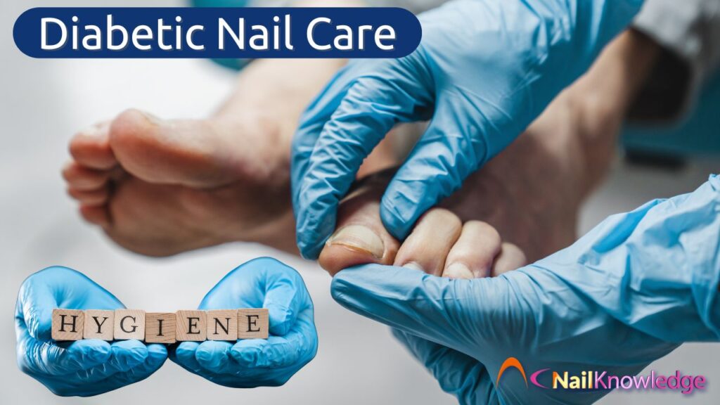 Diabetic nail care treatment