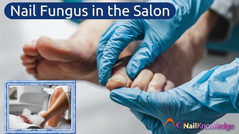 Nail Fungus in the Salon