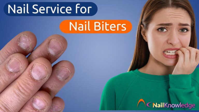 Nail Services for Nail Biters