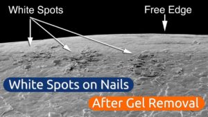 Manchas blancas en las uñas Daños o deshidratación