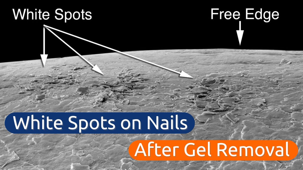 White Spots on Nails Damage or Dehydration