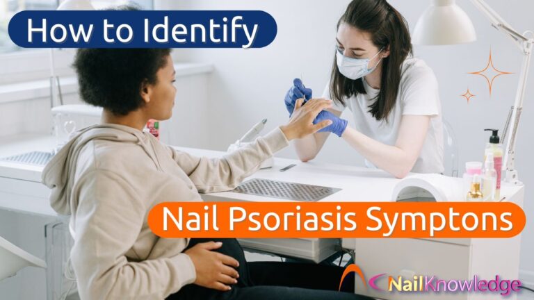 Nail Psoriasis Symptoms in Clients