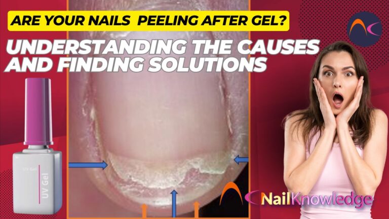 Nails Peeling Off After Gel? Here’s What You Need to Know