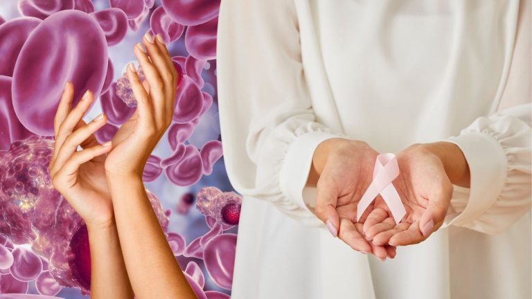 Nail Care During Cancer Treatment